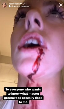 «Манчестер Юнайтед» о ситуации с Гринвудом: «Мы против любых форм насилия»